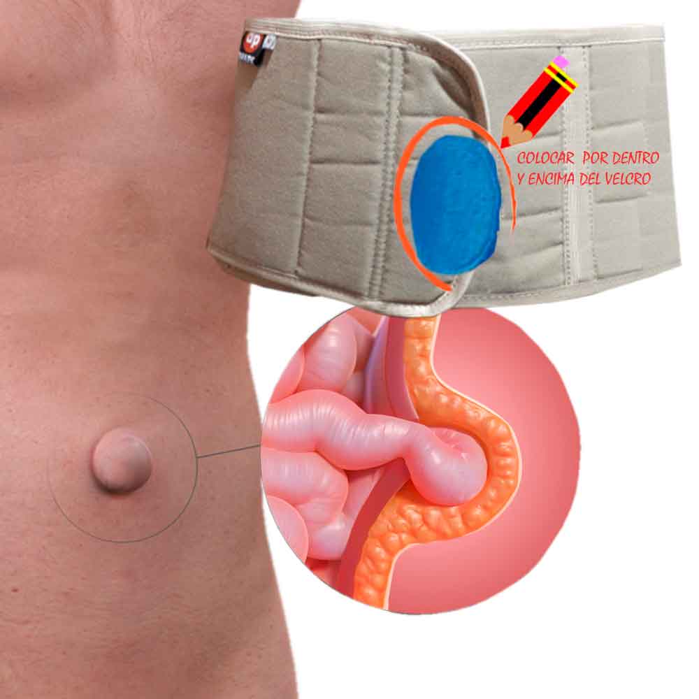 Faja para Hernia Umbilical Dhark Unisex Color Piel y de Talla Doble XXL ...