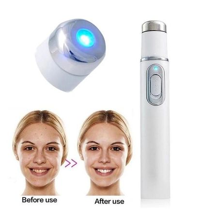 Dispositivo Laser Luz Azul Hot Tonificador Piel Marcas de Acné Genieka