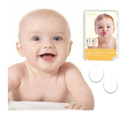 Otostick Corrector Estético De Orejas Bebé Oido