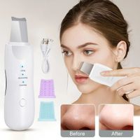Exfoliante Ultrasonico de la Piel Limpieza Profunda de Poros Faciales