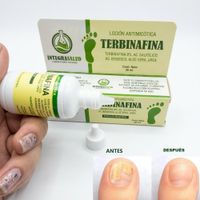 Terbinafina en Gota Tratamiento para Hongos en las Unas y Pies 3 Unid